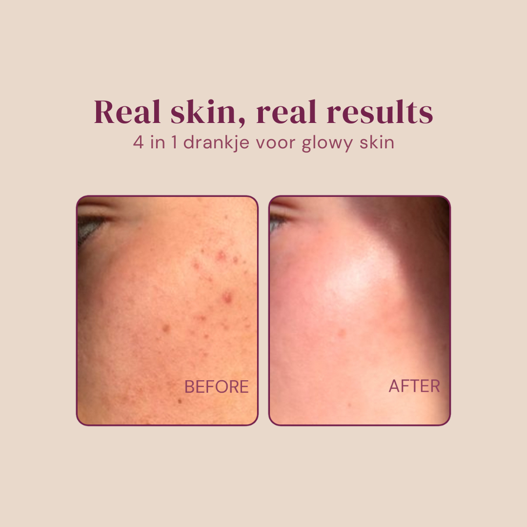 Herbolist Collageen Collaccino