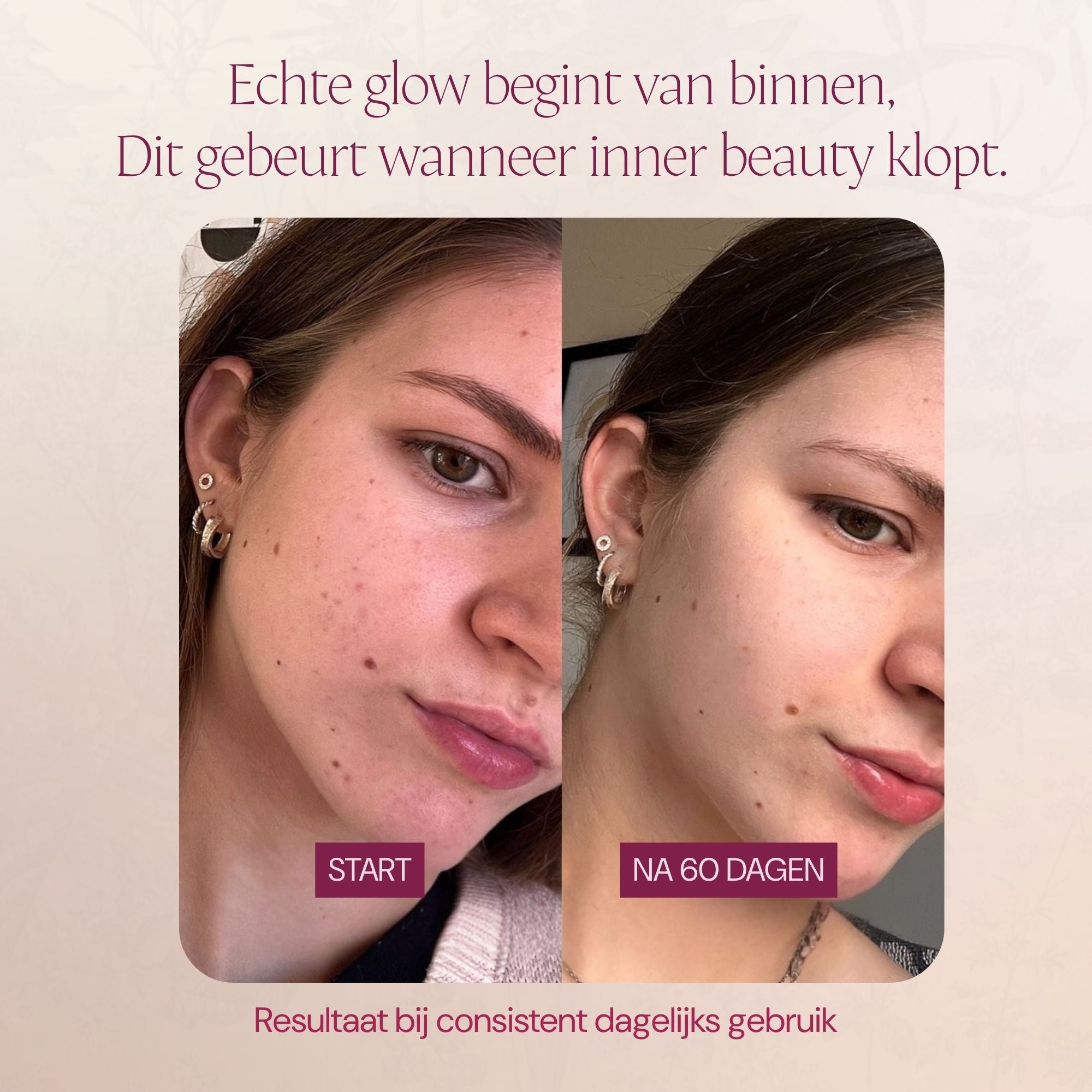 Hair &amp;amp; Skin Glow Bundle